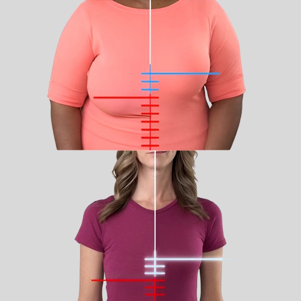 FRONTBRA